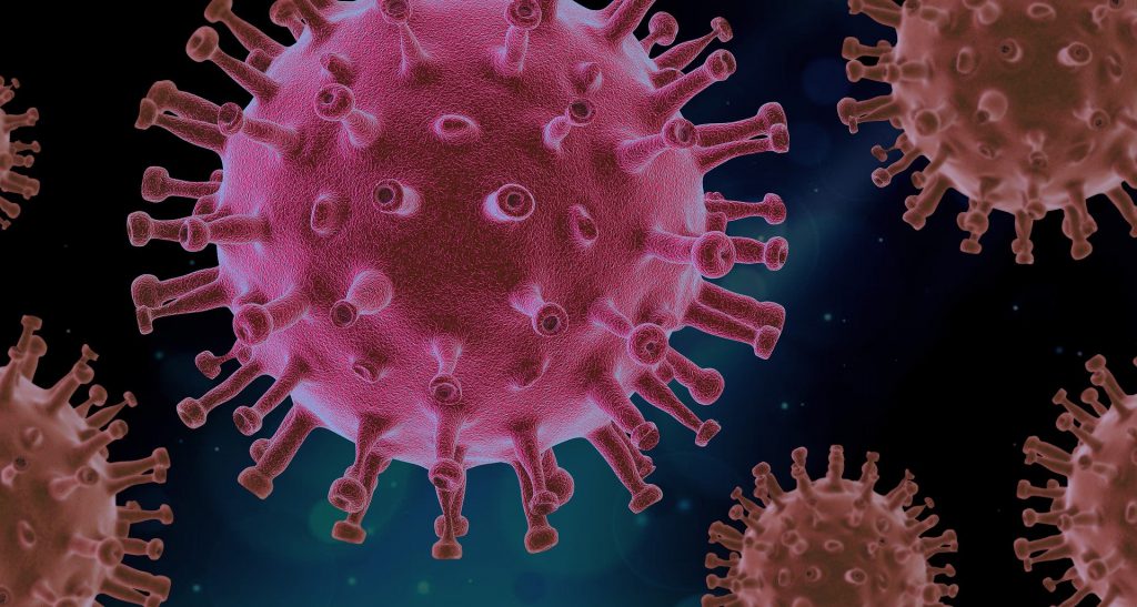 How does  Effective Public Financial Management Improve COVID-19 Pandemic Responses?